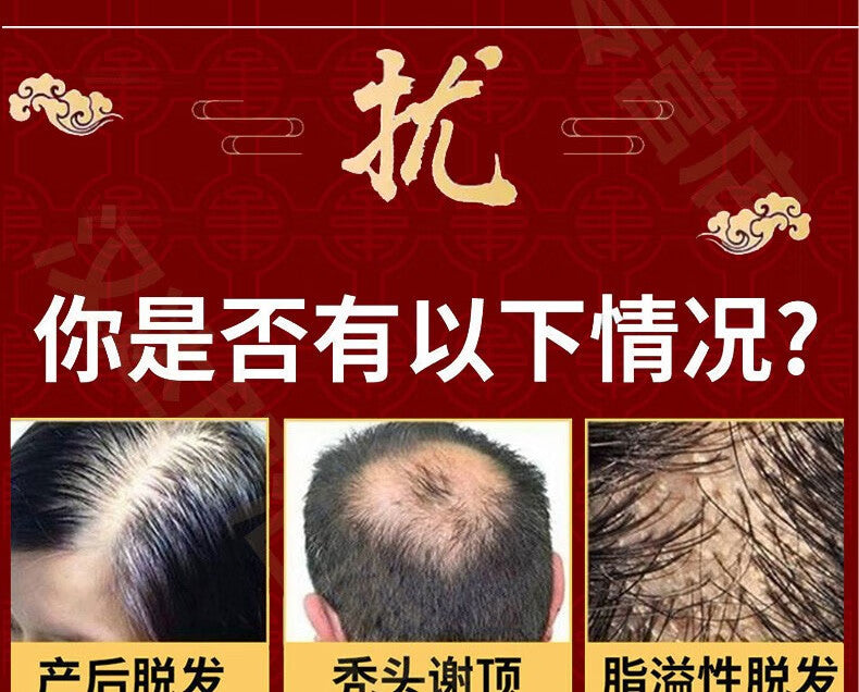 Natural Herbal Hair growth cream, suitable for both men and women, for seborrheic hair loss. Hair Care Health Paste